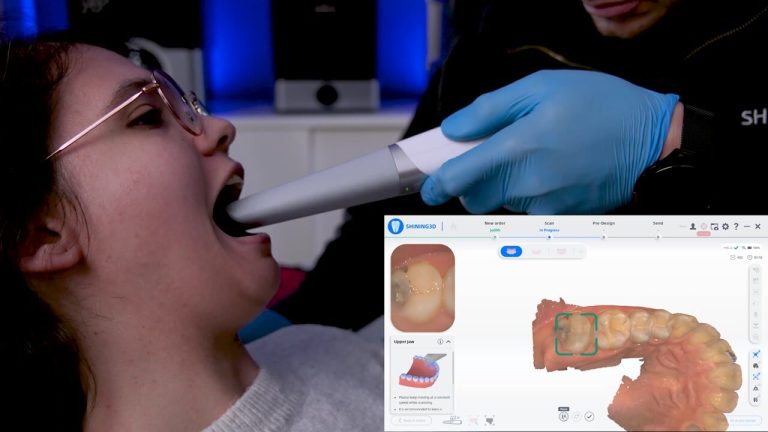 Medidenta - Videos - Aoralscan 3 (Wireless) Operating