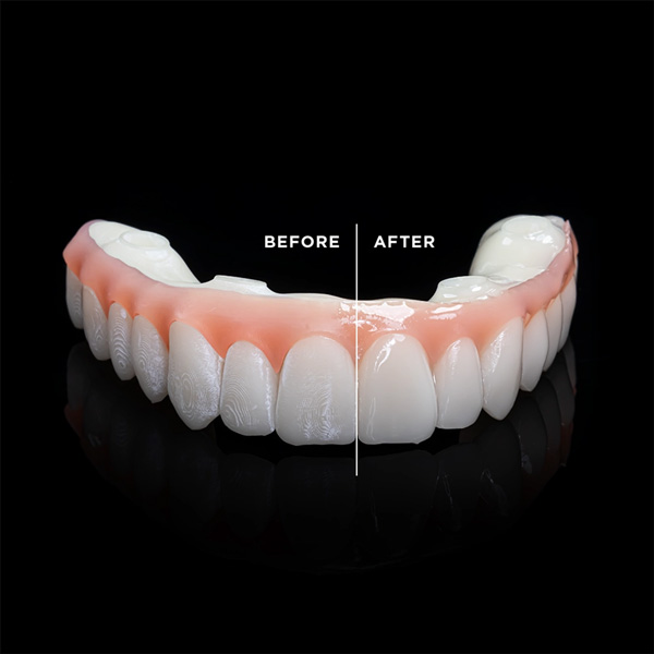 Medidenta - 3D Printing - Resins - Rodin® Glaze N2-Free Gallery 03