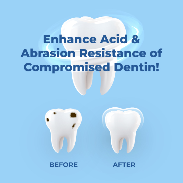 Medidenta - SDF Pro™ 38% Silver Diamine Fluoride Solution Unit Dose Kit - Gallery 04